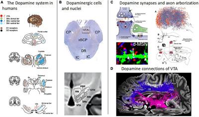 Magnetic resonance imaging of the dopamine system in schizophrenia – A scoping review